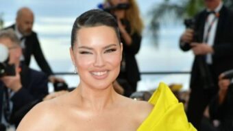 Adriana Lima na udaru žestokih kritika: “Ne liči na sebe”