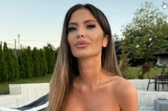 “NADROGIRANA, PRETUČENA VODITELJICA…” Ana Radulović javno o jezivim komentarima zbog zatvorenog oka
