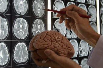 Naučna studija potvrdila da je pisanje rukom mnogo bolje za zdravji mozak