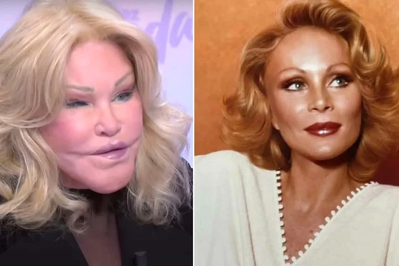 Jocelyn Wildenstein