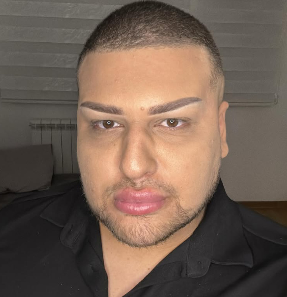 SRPSKI TIKTOKER ZAVRŠIO U BOLNICI/Photo: Printscreen