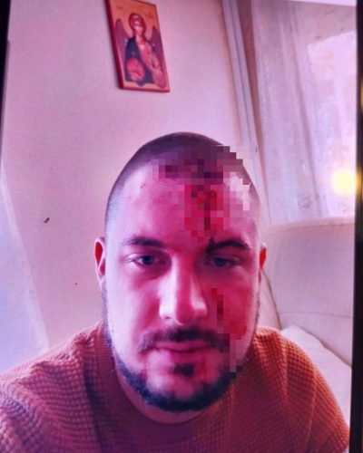 UZNEMIRUJUĆE! Mimas i Gruja se TU*LI – ona ga prijavila za na*ilje? / Photo: Printscreen