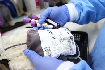 Hitno potrebna krv Sarajki Rosi Tolj koja leži na UKC-u RS