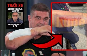 (OPREZ) UZNEMIRUJ*ĆE FOTOGRAFIJE IZMASAKRIR*NE RUKE SAŠE MIRKOVIĆA: Evo kako izgleda RUKA čelnika Hype televizije nakon KRVNIČK*G POKUŠAJA UB*STVA