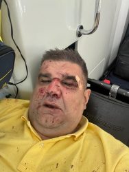 “MIRKOVIĆ NIJE UČESTVOVAO U TUČI, NEGO JE MUČKI NAPADNUT” Izvor Hype TV-a za Avaz!