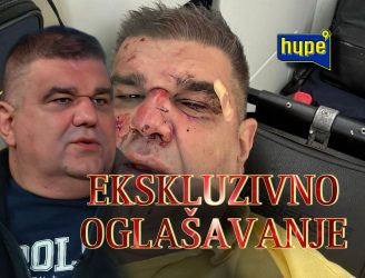 PRVO OGLAŠAVANJE SAŠE MIRKOVIĆA IZ BOLNICE! NAPADNUT KUKAVIČKI S LEĐA, PA GA NA PODU MUČKI ŠUTIRALI U GLAVU