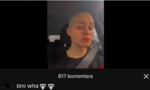 Sofi Tkačenko obrijala glavu!