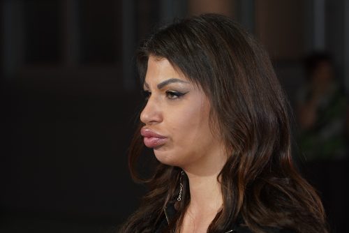 MILJANA KULIĆ HITNO PREBAČENA U URGENTNI CENTAR?!