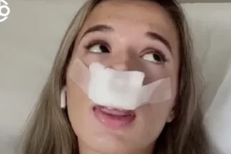 Tiktokerka operisala nos da bi njena buduća djeca bila ROĐENA SA LIJEPIM NOSEM!