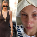 BELA HADID KROZ SUZE PROGOVORILA O BOLESTI