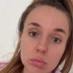 Lea Stanković riješila da izvadi hijaluron iz usana