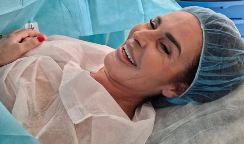 Milena Kačavenda ponovo mora na operaciju, otkrila kakve posljedice i dalje trpi: "DOBILA SAM HEKLER U GLAVU!“